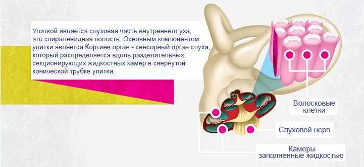 Шум в ушах (тиннитус)