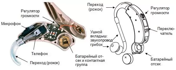 Слуховий апарат: схема, функціонал, комплектуючі