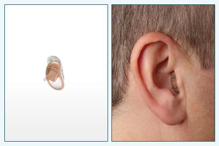 Внутриканальные слуховые аппараты