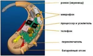 Рекомендации по использованию слуховых аппаратов