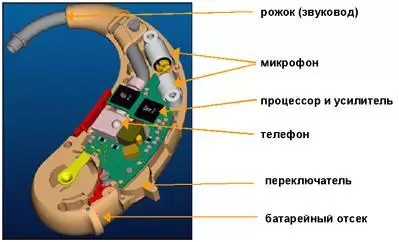 Как устроен слуховой аппарат