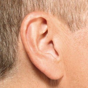 Внутриканальный слуховой аппарат в ухе