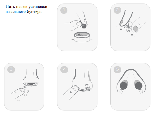 установка-назального-бустера