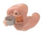 Рекомендації по використанню слухових апаратів батарейный отсек