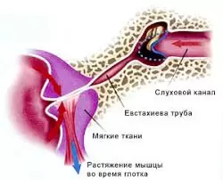 После дайвинга заложило ухо, что делать?