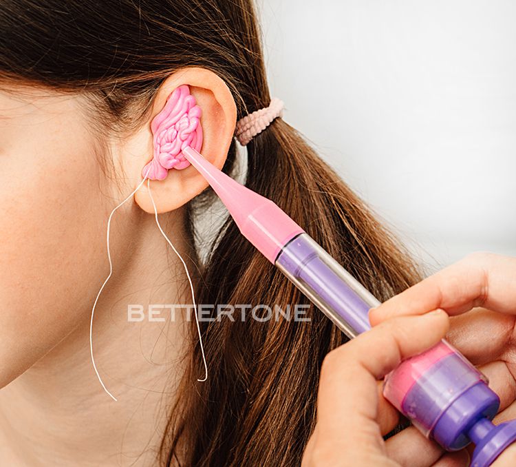 Вливание массы в ухо (ушной слепок) фото