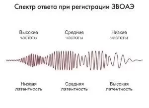 Аудиологический скрининг новорожденных методом отоакустической эмиссии (ОАЭ)