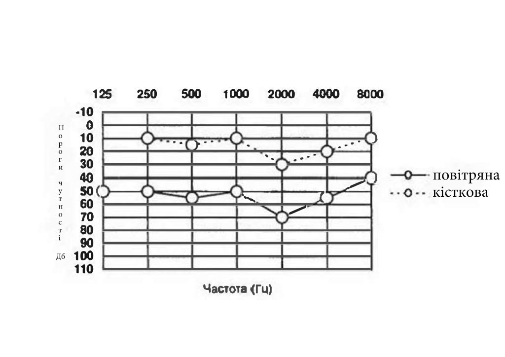 Комплексне аудіометричне дослідження слуху: точність, комфорт і результат Комплексне аудіометричне дослідження слуху: точність, комфорт і результат