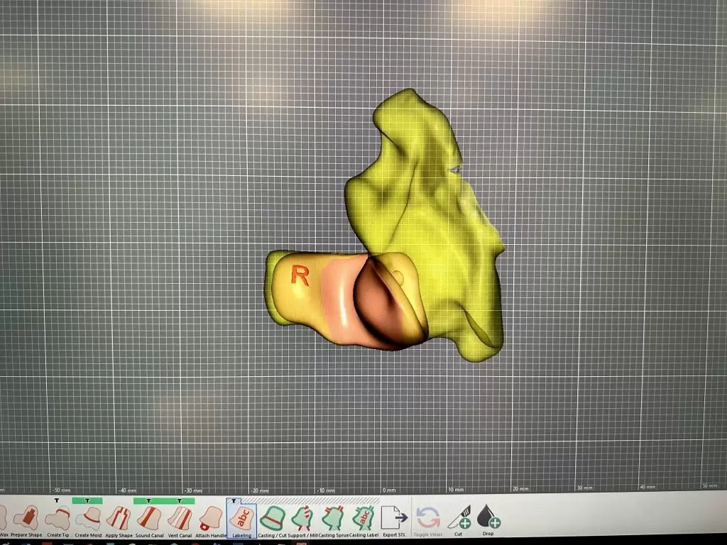 Изготовление корпусов внутриушных слуховых аппаратов