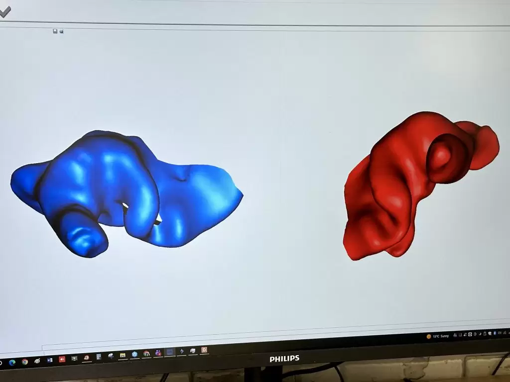 Порівняння цифрових 3D-моделей зліпків фото Виготовлення корпусів внутрішньовушних слухових апаратів
